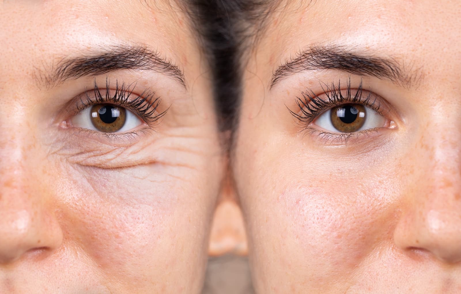 A split close-up of a woman's eyes, one side showing under-eye wrinkles and the other smooth skin.